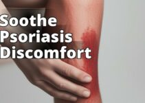 The Benefits Of Cannabidiol For Psoriasis Treatment